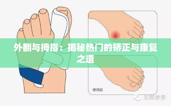 外翻与拇指：揭秘热门的矫正与康复之道