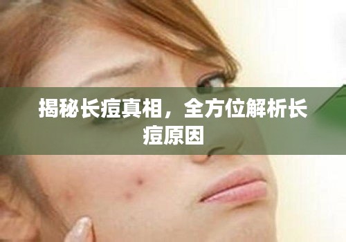 揭秘长痘真相，全方位解析长痘原因